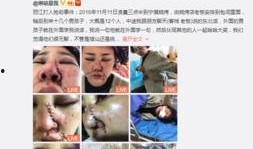 爆料博主毁容视频大全,毁容视频大全深度解析