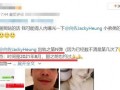 向佐直播爆料视频大全集,揭秘娱乐圈幕后真相与精彩瞬间